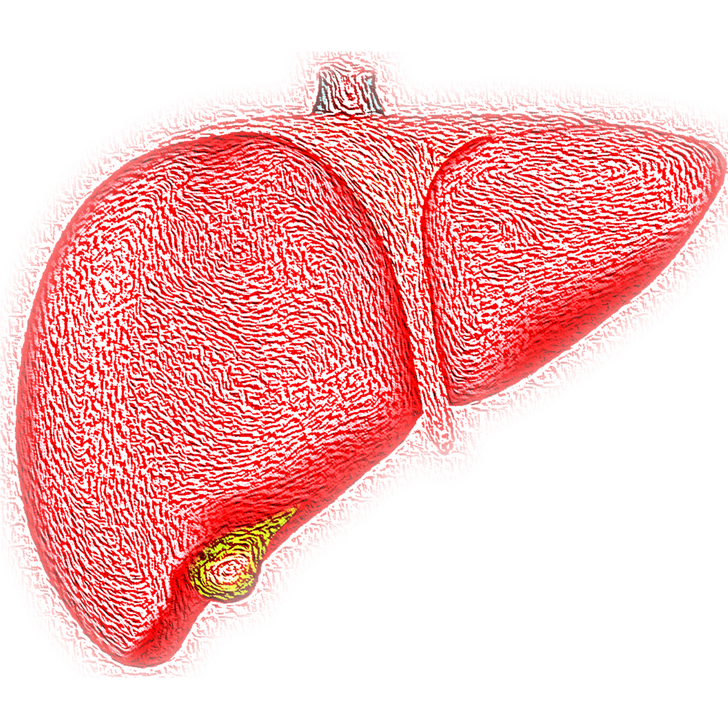 Healing Fatty Liver with Chaga - AlaskaChaga
